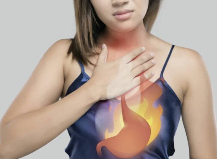 uesta condizione, sebbene di norma transitoria e spesso legata a fattori alimentari o abitudini scorrette, può richiedere attenzione medica